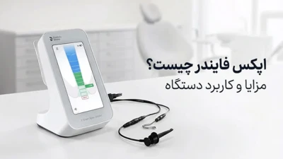 اپکس فایندر چیست؟ مزایا و کاربرد دستگاه